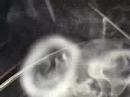 Hookah Rings and Clouds Hookah Rings and Clouds